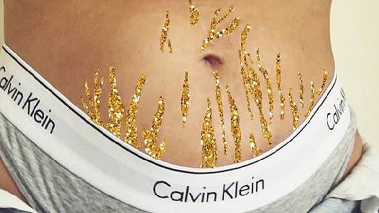 Stretch mark (Foto: Instagram/ @sarashakeel) Stretch mark (Foto: Instagram/ @sarashakeel)