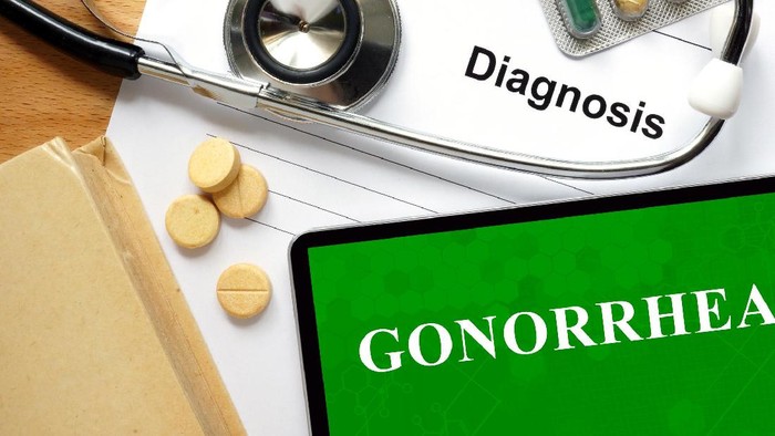 Seks Tak Aman Bisa Picu Gonore, Penyakit Kelamin yang Tingkatkan Risiko HIV