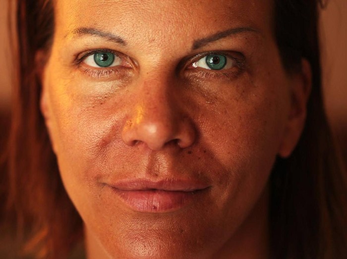 Foto Pakai Laser, Orangorang Ini Mengganti Permanen Warna Matanya