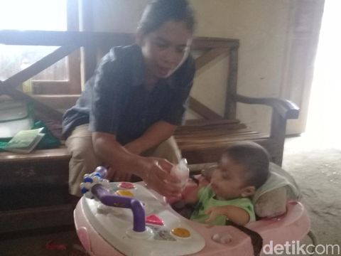 Ahmad Rifki Ariwikri, balita usia 3 tahun memiliki kelainan komplek/