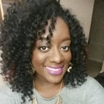 Sebelum alami vitiligo