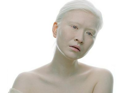 Tubuhnya Serba Putih, Wanita Ini Jadi Model Pertama dengan Albinisme