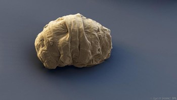 Penelitian dari Oxford University sendiri menunjukkan, tiga fenomena mematikan yang berpotensi dapat terjadi pada Bumi, yaitu tabrakan asteroid, ledakan bintang (supernova), hingga pancaran sinar gamma, tidak dapat mengakhiri hidup Tardigrade. (Foto: Eye of Science/SPL)