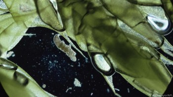 Tardigrade diketahui mampu bertahan ketika dibekukan, terkena radiasi, hingga berada di ruang hampa udara. Hal itu diperkirakan terjadi karena 18% genom di dalam DNA-nya merupakan adaptasi dari berbagai organisme lain, seperti jamur, bakteri, hingga virus. (Foto: Eye of Science/SPL)