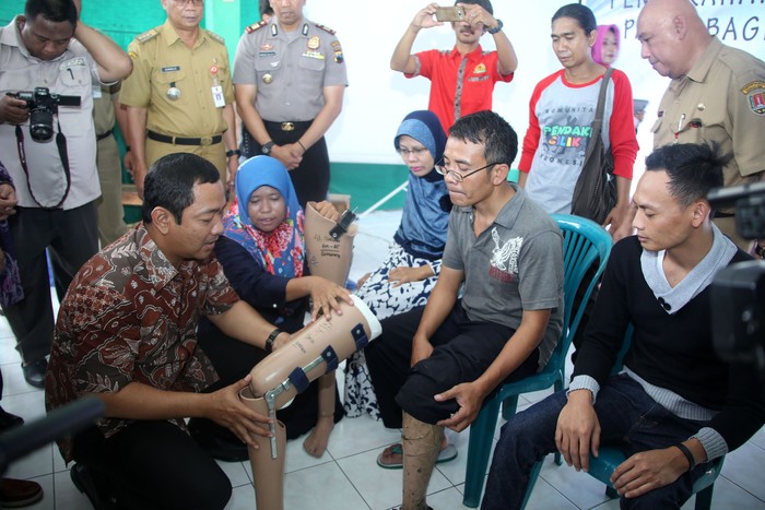 Senyum Penyandang Disabilitas Saat Dapat Berjalan Normal Lagi