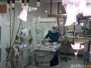 RSHS Belum Putuskan Tindakan untuk Bayi Kembar Siam Asal Padalarang