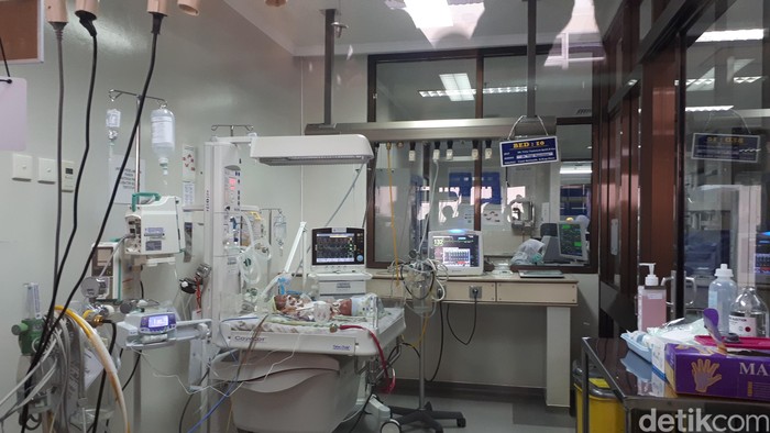 RSHS Bandung Rawat Bayi Kembar Siam Dempet Perut dan Pinggul