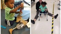 Siapa sangka, di ulang tahunnya yang ke-2 baru-baru ini, Jaylen membuktikan ia bisa berjalan dengan kaki barunya. Mental dan motivasinya sangat kuat untuk anak seumurannya, puji Eric Fornari, direktur bagian ortopedi anak dari The Childrens Hospital, Montefiore. (Foto: GoFund Me/Jaylens First Steps)