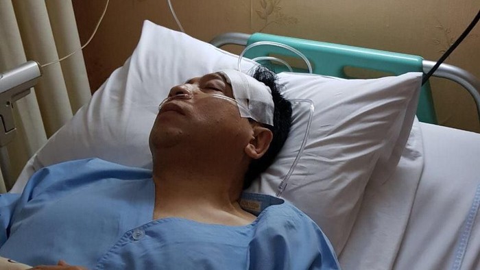 Foto: Beredar foto Setya Novanto kecelakaan (Istimewa) Foto: Beredar foto Setya Novanto kecelakaan (Istimewa)