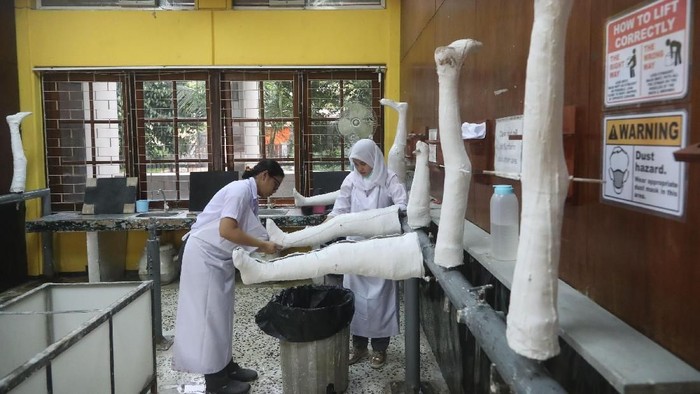 Ilustrasi foto prostetik kaki. Foto: Grandyos Zafna/detikcom Ilustrasi foto prostetik kaki. Foto: Grandyos Zafna/detikcom