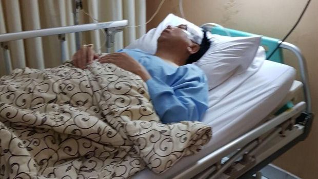 Beredar Foto Novanto Diperban Pasca Kecelakaan, Ini Penampakannya