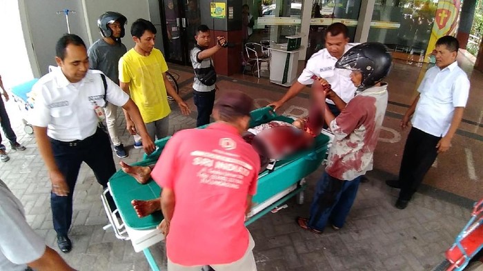 Cakram Gergaji Lepas saat Digunakan, Lengan Pria ini Nyaris Putus