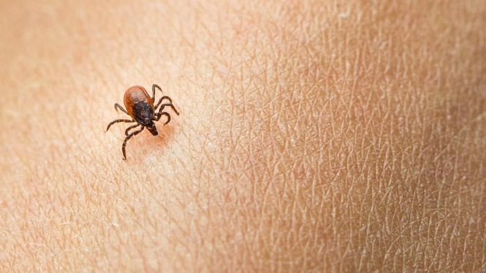 Tick - parasitic arachnid blood-sucking carrier of various diseases on a human skin