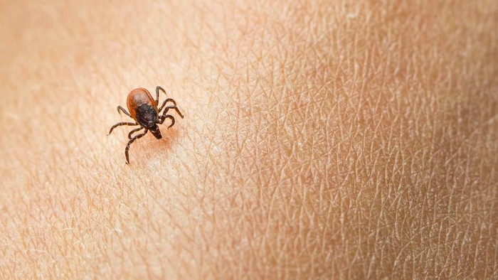 Ilustrasi kutu Tick - parasitic arachnid blood-sucking carrier of various diseases on a human skin