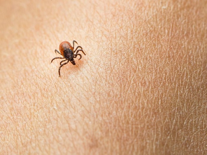 Bisakah Orang Meninggal Karena Dimakan Oleh Kutu?