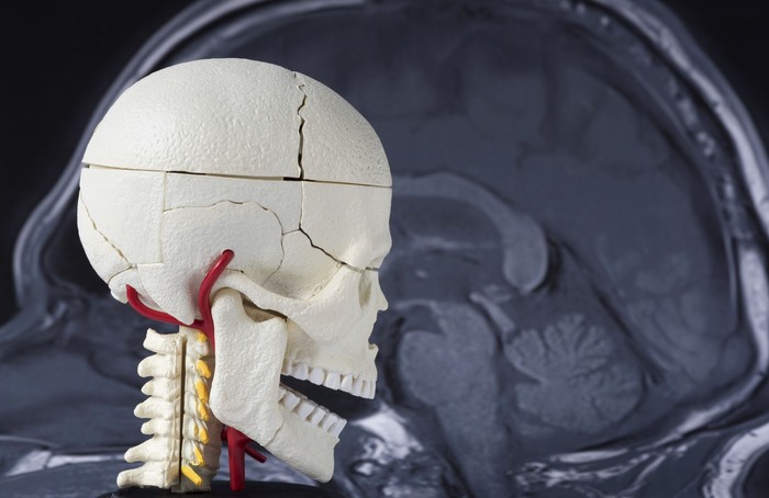 Human skull model on the MRI of the brain background