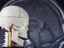 Riwayat Gegar Otak Picu Turunnya Kemampuan Kognitif, Begini Studinya