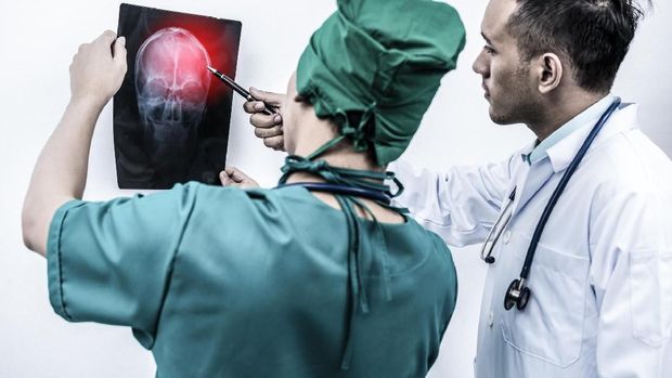 Mengenal Indikasi Gegar Otak Seperti Dialami Setya Novanto