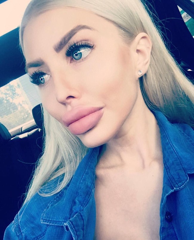 Wanita asal Polandia itu pun mengaku sudah ketagihan operasi plastik. Hal tersebut dimulai ketika ia mengubah bentuk hidung untuk pertama kalinya. Melihat hasil yang memuaskan, Anella pun tak ragu untuk kembali melakukan operasi lainnya. Foto: Instagram Anella An