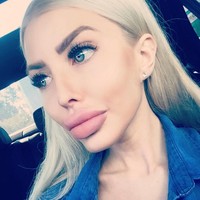 Wanita asal Polandia itu pun mengaku sudah ketagihan operasi plastik. Hal tersebut dimulai ketika ia mengubah bentuk hidung untuk pertama kalinya. Melihat hasil yang memuaskan, Anella pun tak ragu untuk kembali melakukan operasi lainnya. Foto: Instagram Anella An