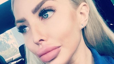 Foto: Ini Anella, Wanita yang Terobsesi Jadi Barbie Hidup Pertama di Dunia