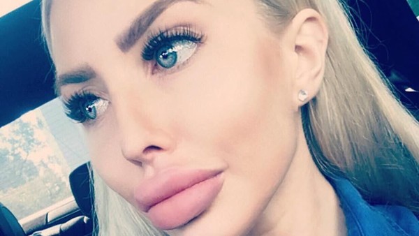 Foto: Ini Anella, Wanita yang Terobsesi Jadi Barbie Hidup Pertama di Dunia