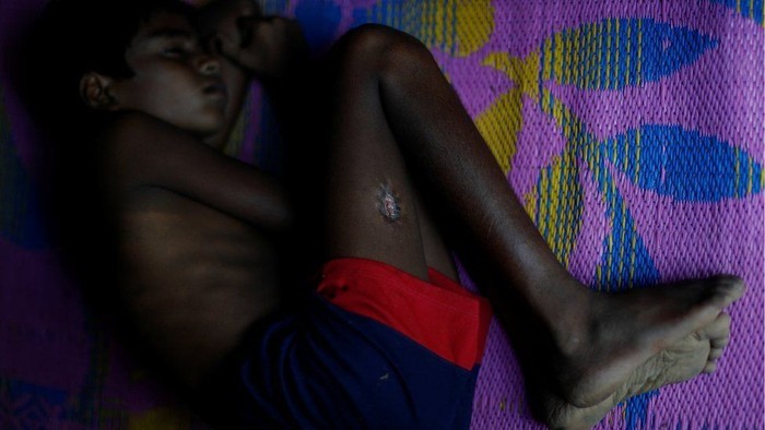 Krisis Rohingya, Mereka yang Dipukuli dan Dibakar