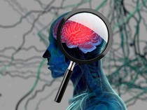 Ngupil dan Potensi Idap Alzheimer