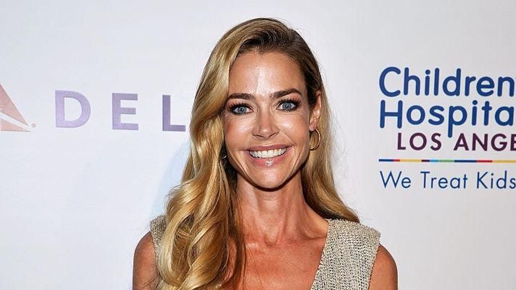 Denise Richards Ngaku Jadi Korban KDRT sampai Diancam Dibunuh, Wajah Bonyok Parah