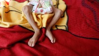 Pemblokadean dilakukan lantaran diduga pasokan senjata untuk militan Houthi berasa dari luar Yaman (Foto: Dok. REUTERS/Khaled Abdullah)