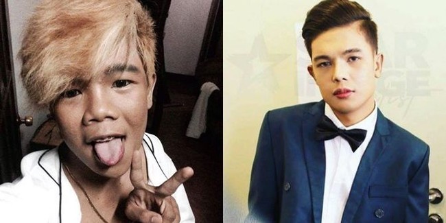 Marlou Arizala cukup dikenal sebagai boyband di Filipina dengan wajahnya yang tak menarik. Setelah hengkang dari groupnya dan tak ingin terus-terusan jadi bahan ejekan, ia pun mengubah penampilannya. Kini wajahnya sangat tampan. Foto: Istimewa