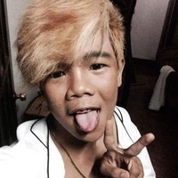 Marlou Arizala cukup dikenal sebagai boyband di Filipina dengan wajahnya yang tak menarik. Setelah hengkang dari groupnya dan tak ingin terus-terusan jadi bahan ejekan, ia pun mengubah penampilannya. Kini wajahnya sangat tampan. Foto: Istimewa