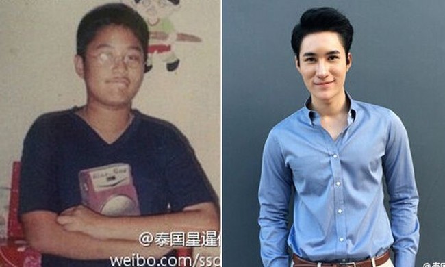 Babapan sempat membuat heboh media sosial karena penampilan wajahnya yang tampan. Sebelumnya, pria asal Thailand ini dikenal memiliki wajah hitam bulat dan berkacamata. Namun, setelah menjalani operasi plastik, Babapan kini mirip dengan member boyband Korea. Foto: Istimewa