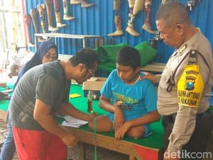 Anshori, Bocah Difabel Asal Bojonegoro Dibuatkan Kaki Palsu