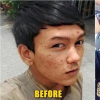 Demi kariernya sebagai model, Amirul Rizwan Musa, pria asal Malaysia ini sudah menjalani operasi plastik sejak 2014 dan menghabiskan biaya sebesar Rp 622 juta.  Foto: Istimewa