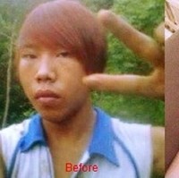 Tom Ngu Yen, pria asal Vietnam ini tak menyerah dengan keadaan genetik yang dimilikinya. Ia pun memilih operasi plastik dan kini menjadi lebih ganteng. Foto: Istimewa