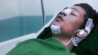 Ia tampak mengubah bentuk hidung, dagunya, serta berbagai prosedur lainnya. (Dok. Instagram/iamxanderford)