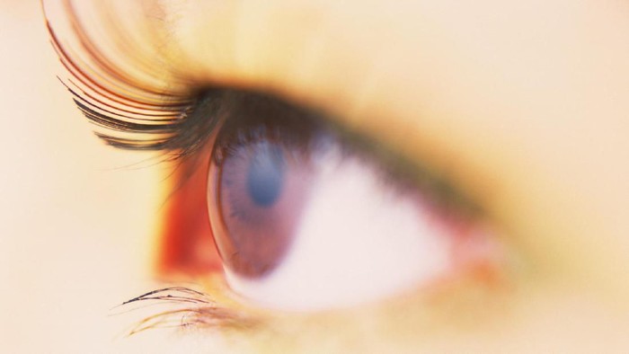 Mata juga bisa terserang melanoma. Foto: thinkstock Mata juga bisa terserang melanoma. Foto: thinkstock