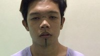 Pria asal Filipina itupun membagi foto dan pengalamannya menjalani proses operasi plastik pada September lalu. (Dok. Instagram/iamxanderford)