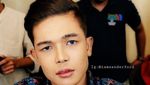 Bosan Dibully Soal Fisiknya, Artis Ini Nekat Operasi Plastik Wajahnya