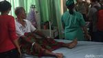 Foto: Kondisi Tangan 5 Murid Debus yang Cuci Tangan Pakai Air Keras