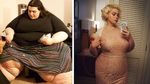 Foto: Dulu Beratnya 300 Kg, Wanita Ini Berjuang Kuruskan Badan