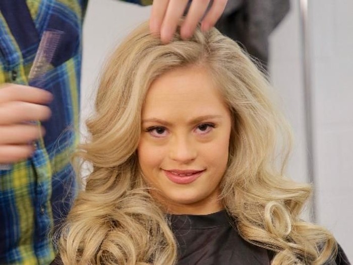 Mikayla Holmgren Mikayla Holmgren menjadi wanita Down Syndrome pertama yang ikut kontes kecantikan Miss Minnesota.