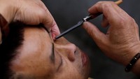 Setelah siap, dia memegang mata pelanggannya dan sedikit menarik kelopak mata bagian bawah, memunculkan sisi dalamnya. Dengan cekatan, Gaowu menggerakkan pisau, mengikis kotoran di kelopak mata (Tyrone Siu/Reuters)