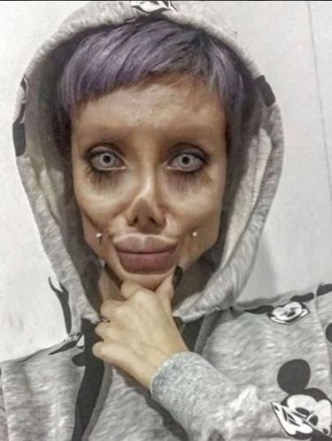 Viral karena Ngaku Operasi Plastik Mirip Jolie, Wanita Ini Ternyata Bohong