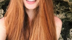 Tidak banyak yang tahu bahwa ketika masih remaja Anastasiya mengalami masalah kerontokan rambut dini. Saat ini ia dikenal sebagai model dengan julukan Rapunzel.