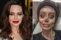 Viral karena Ngaku Operasi Plastik Mirip Jolie, Wanita Ini 