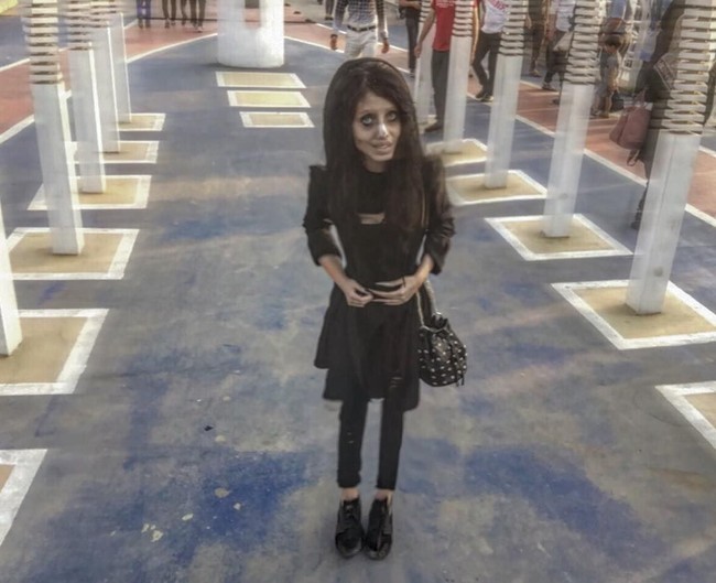 Berat badannya kini hanya 35 kg. Dengan tinggi 146 cm, berdasarkan indeks massa tubuh, Sahar Tabar bisa dikategorikan underweight. Foto: Dok. Instagram