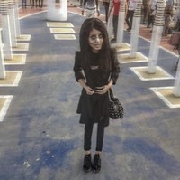 Berat badannya kini hanya 35 kg. Dengan tinggi 146 cm, berdasarkan indeks massa tubuh, Sahar Tabar bisa dikategorikan underweight. Foto: Dok. Instagram