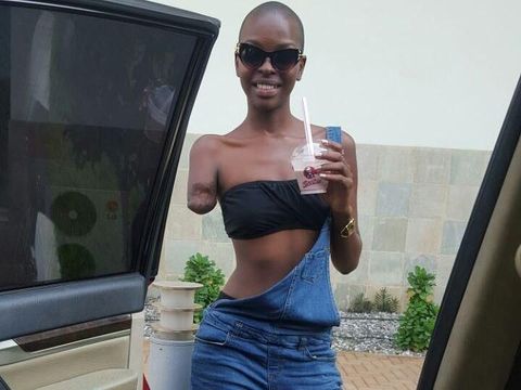 Lumenni Bombo, Wanita yang Punya Satu Lengan Ini Sukses Jadi Model